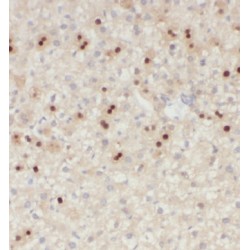 Kinesin Family Member 18A (KIF18A) Antibody