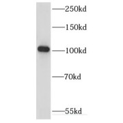 WB analysis of Jurkat cells, using KIF18A antibody (1/500 dilution).