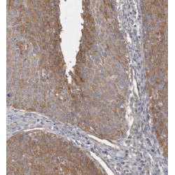 Kinesin-Like Protein KIF22 (KIF22) Antibody