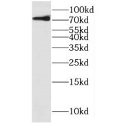 WB analysis of human heart tissue, using KIF22 antibody (1/400 dilution).