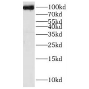 WB analysis of HeLa cells, using KIF2A antibody (1/1200 dilution).