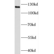 WB analysis of mouse brain tissue, using KIF5A antibody (1/2000 dilution).