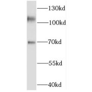 WB analysis of rat brain tissue, using KIF5C antibody (1/1500 dilution).