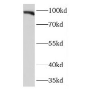 WB analysis of human brain tissue, using KIFAP3 antibody (1/600 dilution).