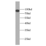 WB analysis of human testis tissue, using KIFAP3 antibody (1/1000 dilution).