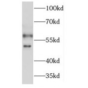 WB analysis of A549 cells, using KCNJ2 antibody (1/200 dilution).