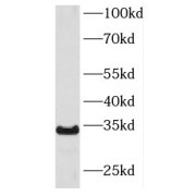 WB analysis of HL-60 cells, using KIR2DS4 antibody (1/500 dilution).