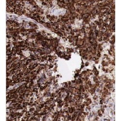 Kir4.1 Antibody