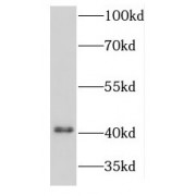 WB analysis of mouse brain tissue, using KCNJ10 antibody (1/500 dilution).