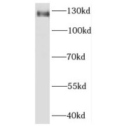 WB analysis of mouse testis tissue, using KIRREL3 antibody (1/400 dilution).