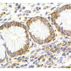 KISS1R-Specific Antibody