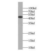 WB analysis of SH-SY5Y cells, using KISS1R-Specific antibody (1/600 dilution).