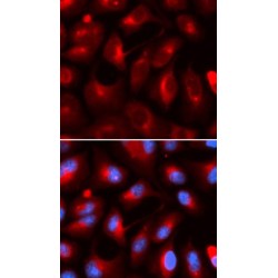 Kinesin Light Chain 1 (KLC1) Antibody