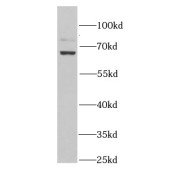 WB analysis of mouse brain tissue, using KLC1 antibody (1/1000 dilution).