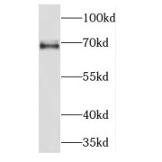 WB analysis of mouse testis tissue, using KLC2 antibody (1/800 dilution).