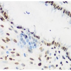 Krueppel-Like Factor 4 (KLF4) Antibody