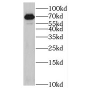 WB analysis of Jurkat cells, using KLHL13 antibody (1/500 dilution).