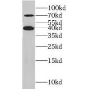 WB analysis of PC-3 cells, using KLHL14 antibody (1/1000 dilution).
