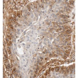 Kelch-Like Protein 14 (KLHL14) Antibody