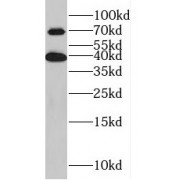 WB analysis of PC-3 cells, using KLHL14 antibody (1/1000 dilution).