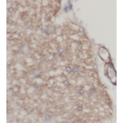 Kelch-Like Protein 21 (KLHL21) Antibody