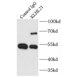 Kelch-Like Protein 21 (KLHL21) Antibody