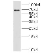 WB analysis of A431 cells, using KLHL21 antibody (1/400 dilution).