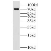 WB analysis of mouse brain tissue, using KLHL22 antibody (1/3000 dilution).