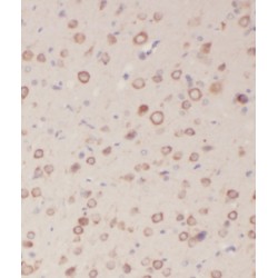 Kelch-Like Protein 4 (KLHL4) Antibody