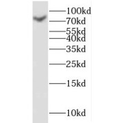 WB analysis of HeLa cells, using KLHL4 antibody (1/600 dilution).