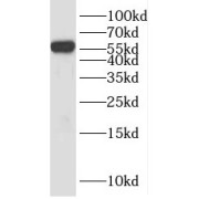 WB analysis of Human peripheral blood leukocyte, using KLRG1 antibody (1/200 dilution).