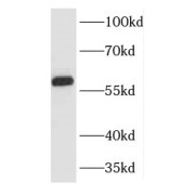 WB analysis of Jurkat cells, using KPNA5 antibody (1/2000 dilution).