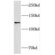 WB analysis of HEK-293 cells, using KRI1 antibody (1/600 dilution).