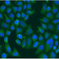 Keratin 6B (KRT6B) Antibody