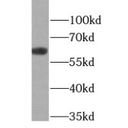 WB analysis of mouse skin tissue, using KRT6B antibody (1/1000 dilution).