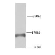 WB analysis of mouse testis tissue, using KTN1 antibody (1/1000 dilution).