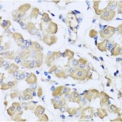 L-2-Hydroxyglutarate Dehydrogenase (L2HGDH) Antibody