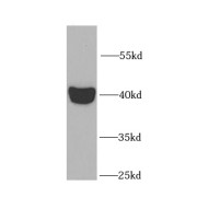 WB analysis of mouse small intestine tissue, using L2HGDH antibody (1/1000 dilution).