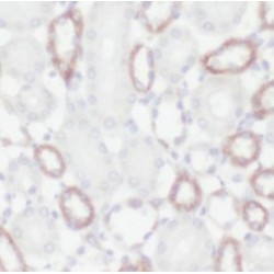 Lactamase Beta 2 (LACTB2) Antibody