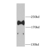 WB analysis of HepG2 cells, using LAMB1 antibody (1/1000 dilution).