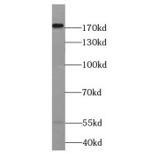 WB analysis of mouse brain tissue, using LAMC3-Specific antibody (1/600 dilution).