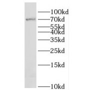 WB analysis of mouse lung tissue, using LAMP3 antibody (1/1000 dilution).