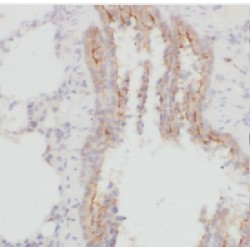 LanC-Like Protein 1 (LANCL1) Antibody