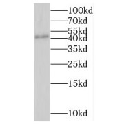 WB analysis of mouse brain tissue, using LANCL1 antibody (1/300 dilution).