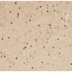 La-Related Protein 4 (LARP4) Antibody