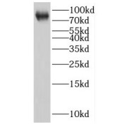 WB analysis of Y79 cells, using LARP4 antibody (1/300 dilution).