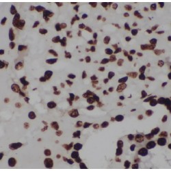 La Ribonucleoprotein Domain Family, Member 7 (LARP7) Antibody