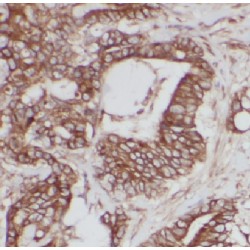 Leucine-tRNA Ligase, Cytoplasmic (LARS) Antibody