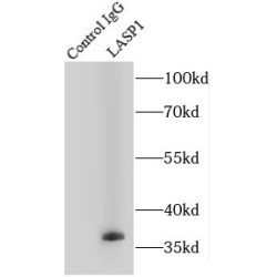 LIM And SH3 Domain Protein 1 (LASP1) Antibody