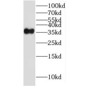 WB analysis of Jurkat cells, using LAT antibody (1/600 dilution).